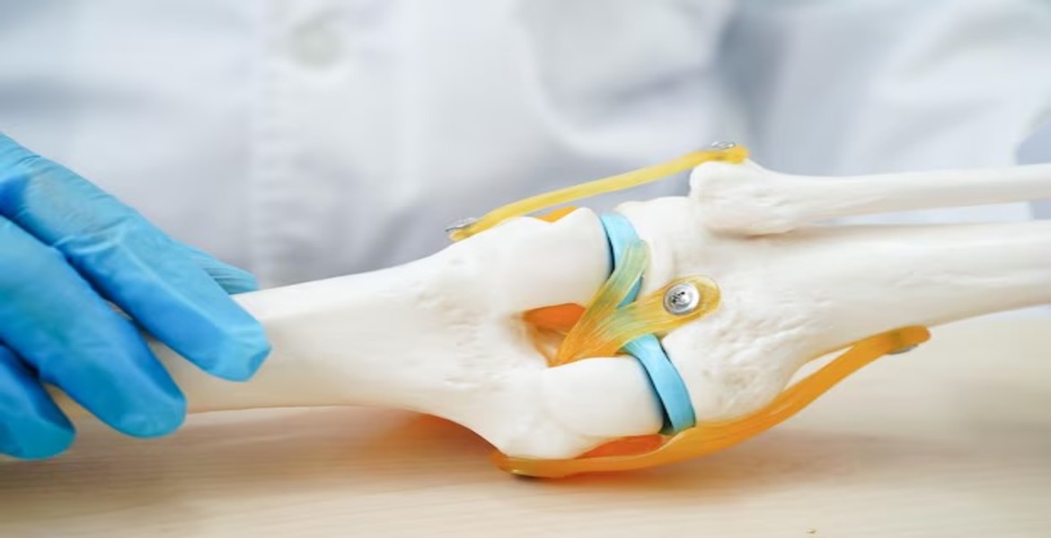 Total Joint Replacement